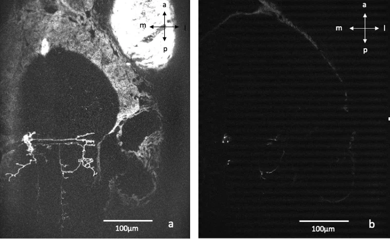 two-photon scan of electroporated larval zebrafish